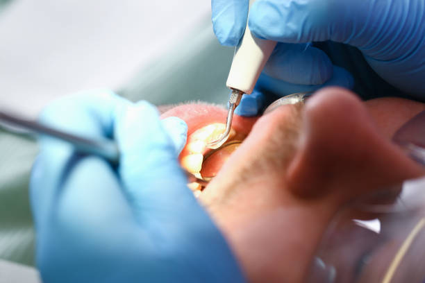 Best Knocked-Out Tooth Emergency  in Post Falls, ID