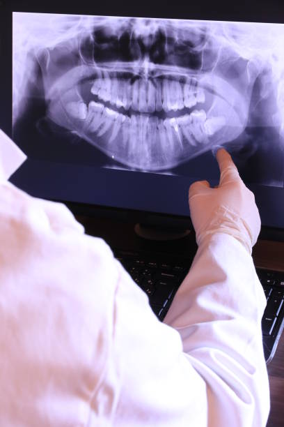 Best Dentist for Tooth Abscess  in Post Falls, ID